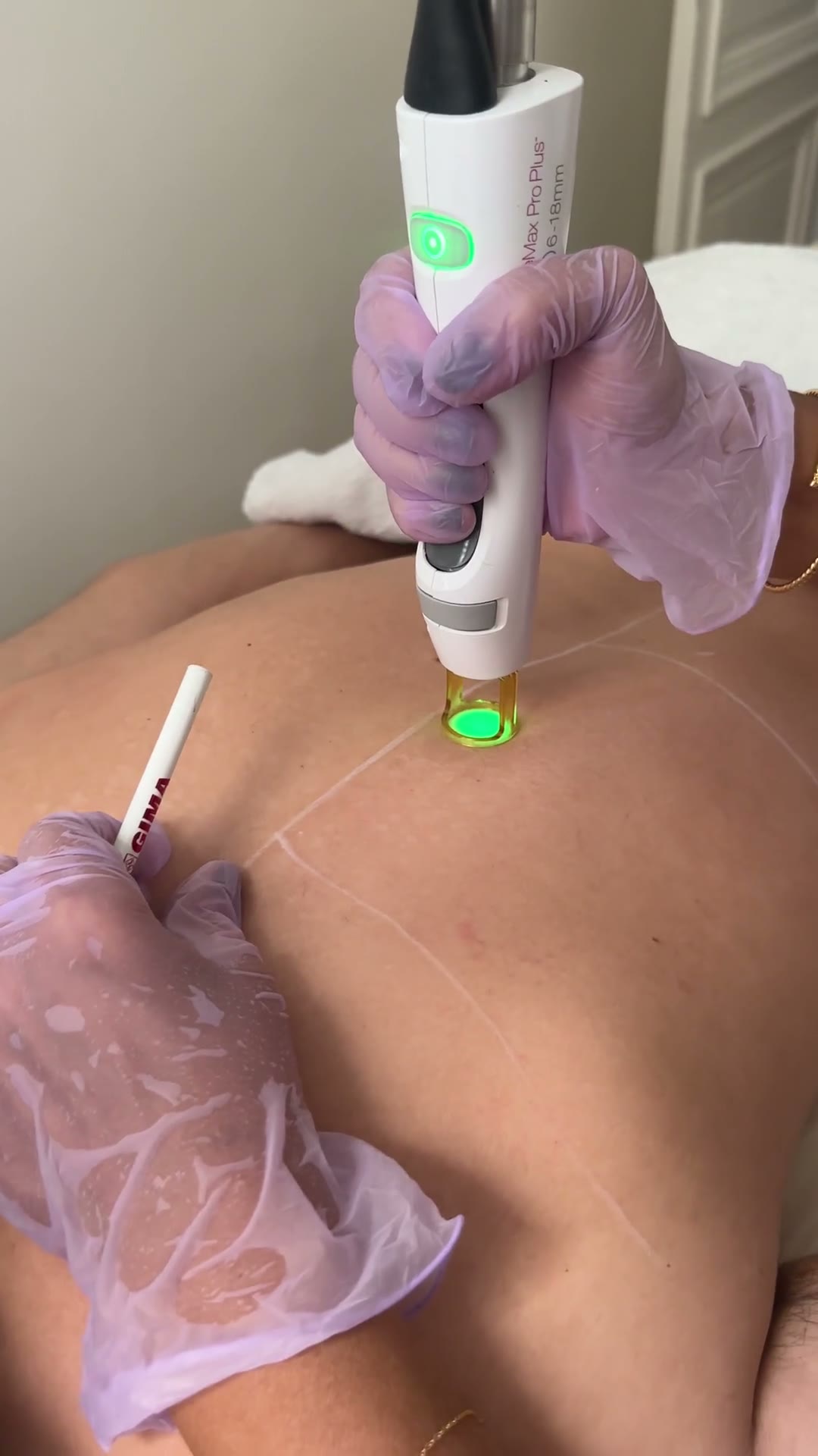 Épilation laser · Karen Hayat Paris